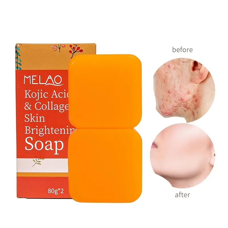 Kojic Acid Skin Brightening Soap