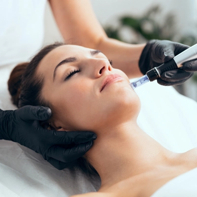 Microneedeling